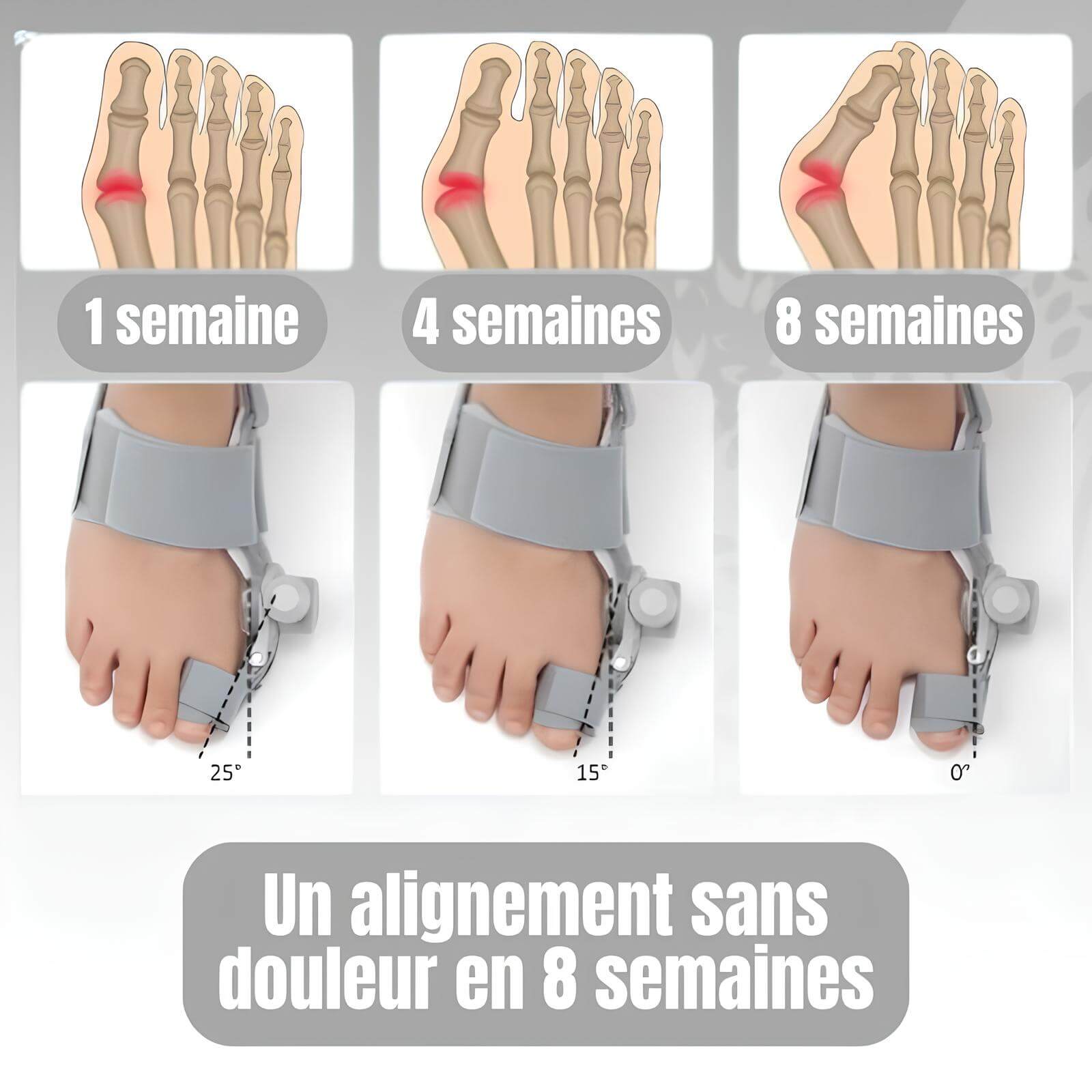 Orthèse Hallux Valgus