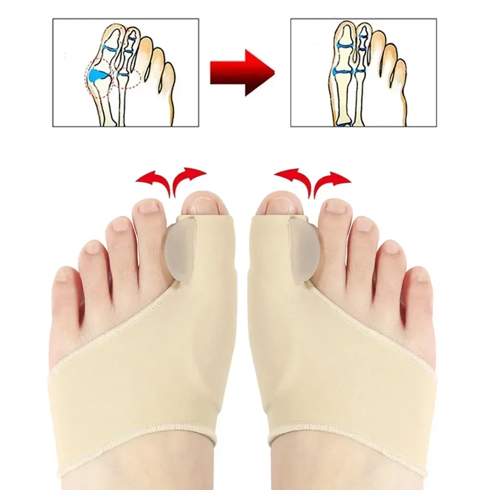 Correcteur Hallux Valgus Relief™ : 7 Bienfaits Essentiels pour Soulager l'Oignon du Pied – Image 5